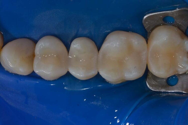 Conservativa Amalgama Dopo