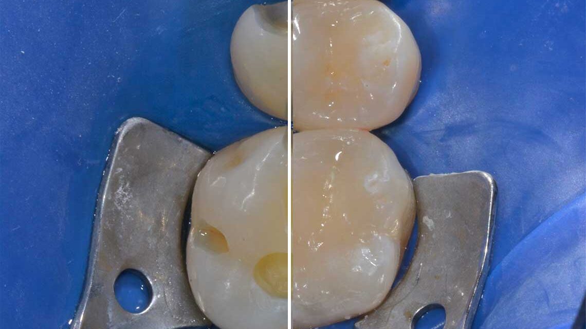 Conservativa Caso Clinico1