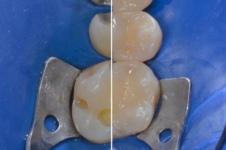 Conservativa Caso Clinico1