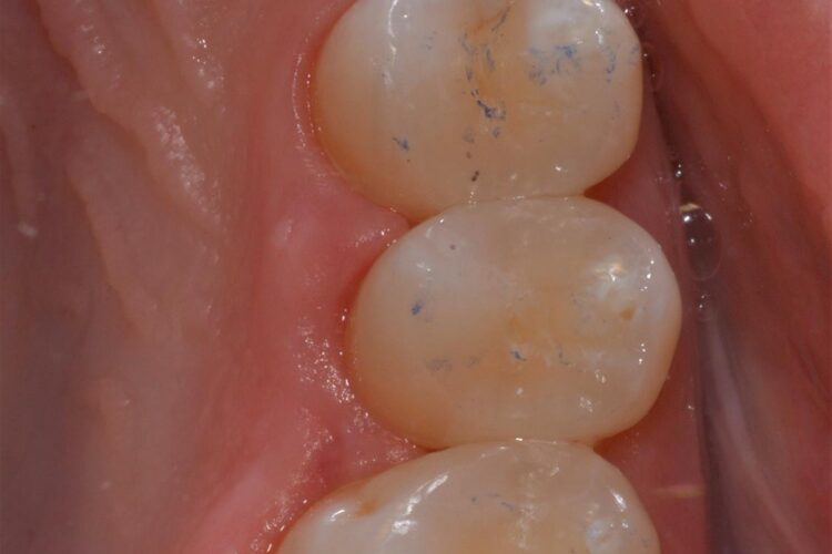 Conservativa Durante