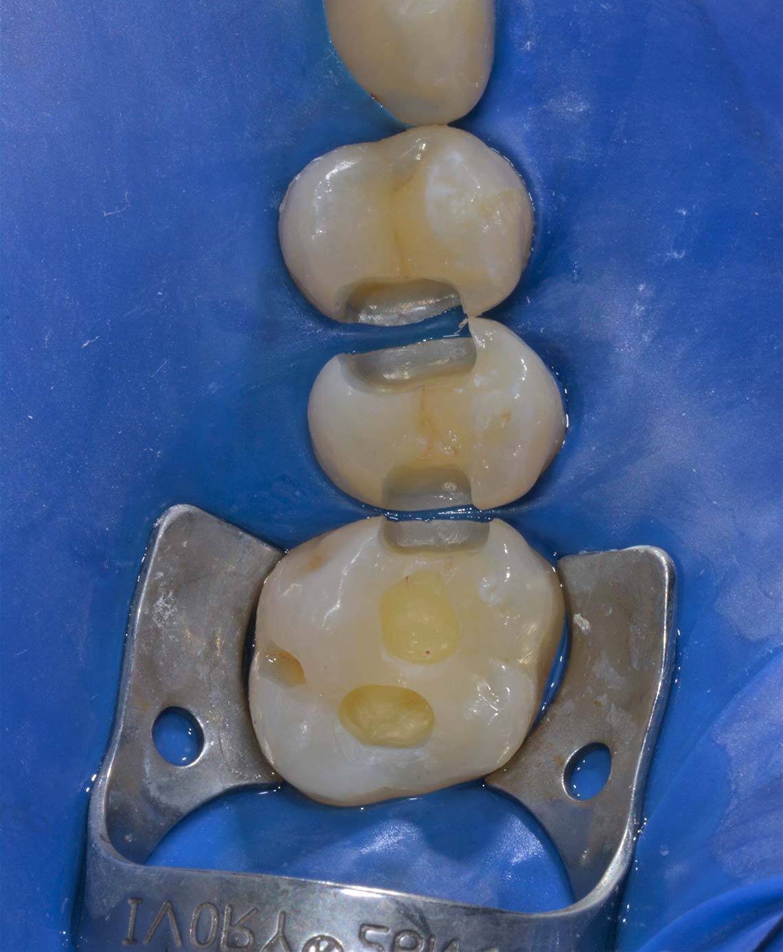 Conservativa Prima 1