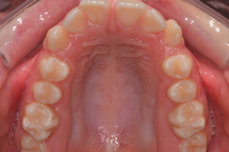 Ortdonzia Adolescenti Caso1 Prima4