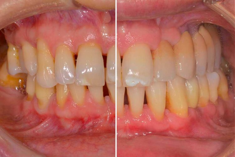 Ortdonzia Adulto Caso Clinico1