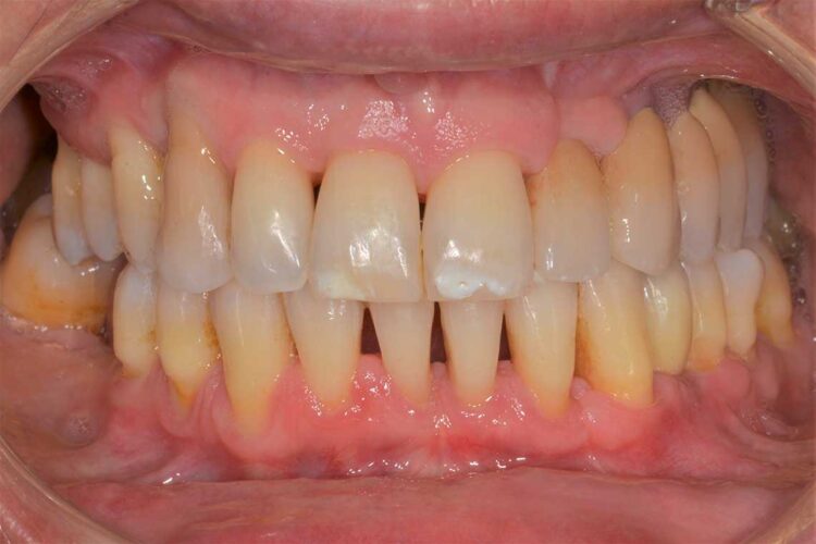 Ortdonzia Adulto Caso1 Dopo1