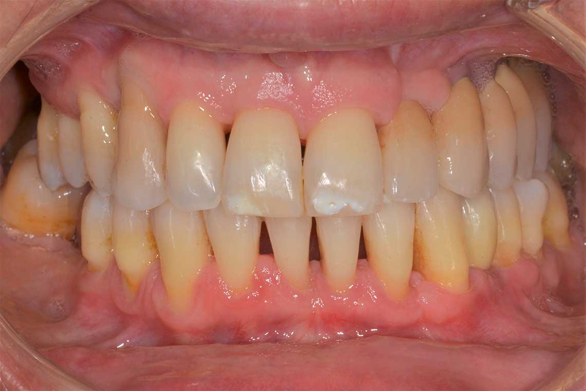 Ortdonzia Adulto Caso1 Dopo1