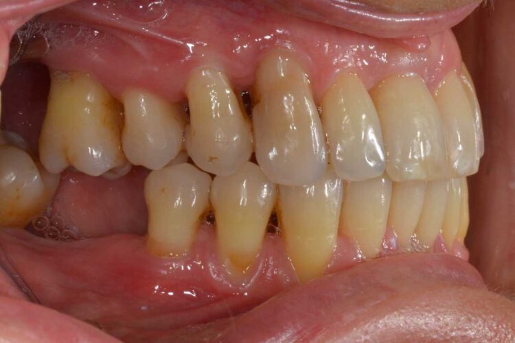 Ortdonzia Adulto Caso1 Dopo3