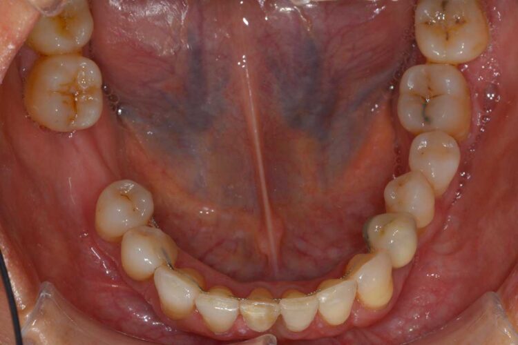 Ortdonzia Adulto Caso1 Dopo5