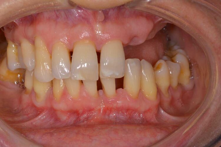 Ortdonzia Adulto Caso1 Prima1