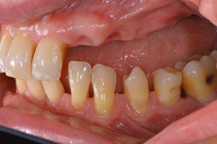 Ortdonzia Adulto Caso1 Prima2