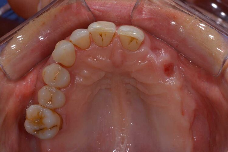 Ortdonzia Adulto Caso1 Prima4