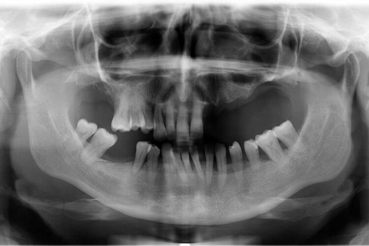 Ortdonzia Adulto Caso1 Prima6