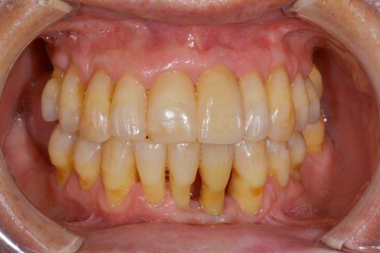 Ortdonzia Adulto Caso2 Dopo1