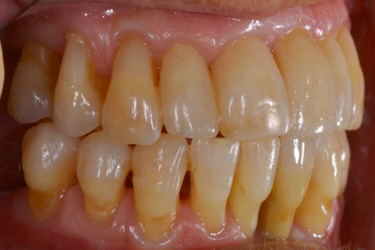 Ortdonzia Adulto Caso2 Dopo2