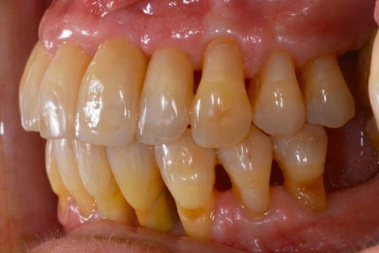 Ortdonzia Adulto Caso2 Dopo3