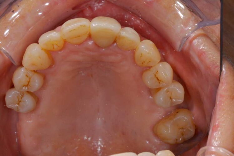 Ortdonzia Adulto Caso2 Dopo4