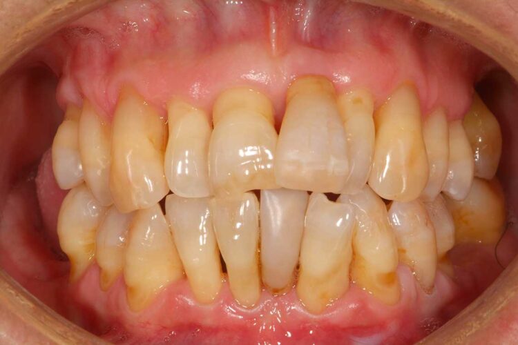 Ortdonzia Adulto Caso2 Prima1