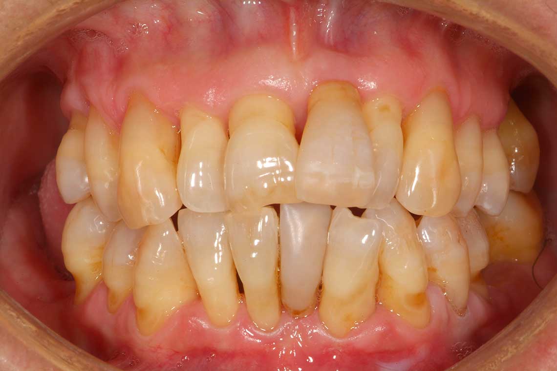 Ortdonzia Adulto Caso2 Prima1