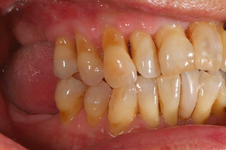 Ortdonzia Adulto Caso2 Prima3