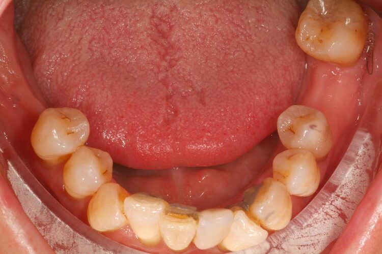 Ortdonzia Adulto Caso2 Prima5
