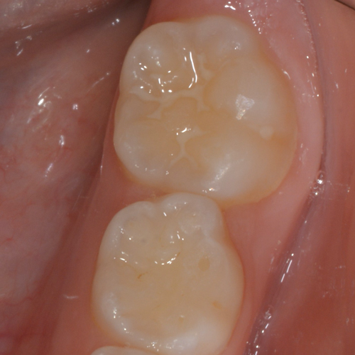 Odontoiatria Pediatrica