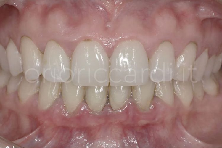 Prevenzione Igiene Prima